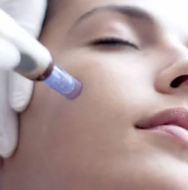 Microneedling